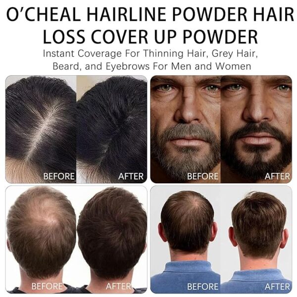 O'CHEAL Black Hairline Powder, Hair Loss Cover Up Powder, Hair Fibers For Thinning Hair, Instantly Root Touch Up Hair Color For Gray Hair Coverage, Sweatproof Hairline Shadow Powder For Men And Women