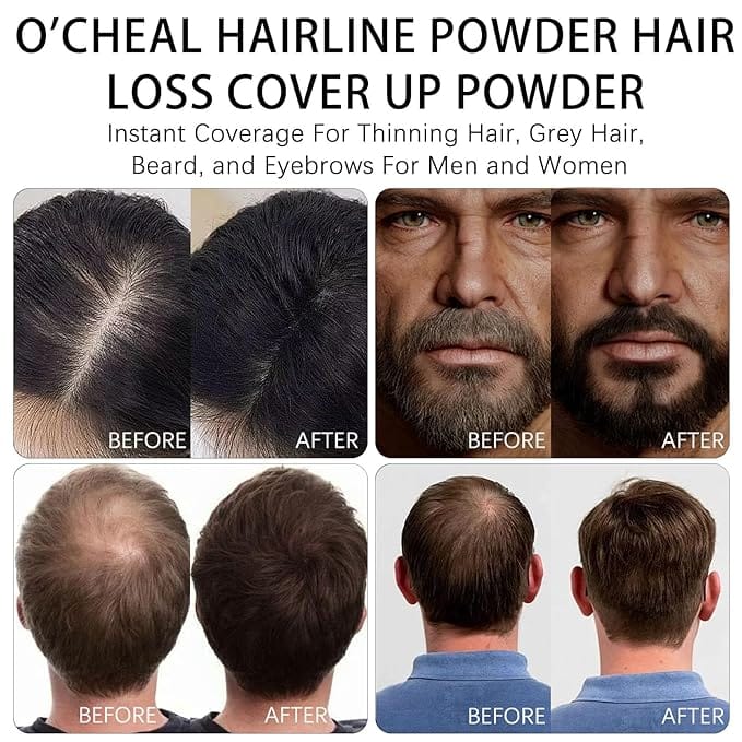 O'CHEAL Black Hairline Powder, Hair Loss Cover Up Powder, Hair Fibers For Thinning Hair, Instantly Root Touch Up Hair Color For Gray Hair Coverage, Sweatproof Hairline Shadow Powder For Men And Women - Image 5